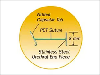 Diagramma dell’impianto UroLift